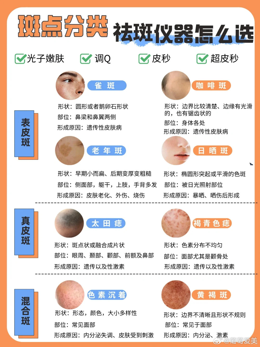 最新祛斑仪器，科技美白的新里程碑